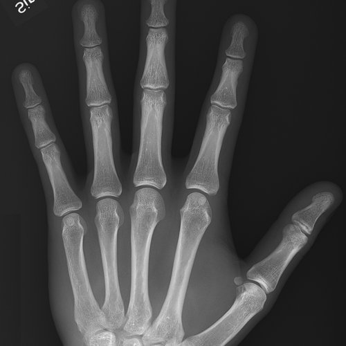 Hand and wrist X-ray